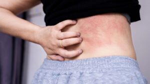 When Does a Rash Need Medical Attention? Signs & Next Steps