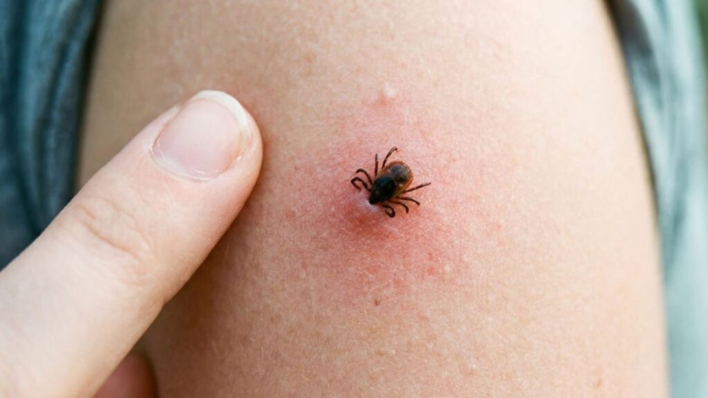 What Are the Most Effective Ways to Keep Ticks Away From Kids and Pets?